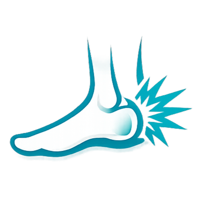 Illustration of a foot with a highlighted heel and blue spikes indicating pain or injury.