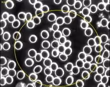 Microscopic view of blood cells, mostly round white cells, with a few yellow circles highlighted.