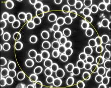 Microscopic view of blood cells, mostly round white cells, with a few yellow circles highlighted.
