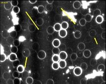 Microscopic view of blood with white circular cells and yellow arrows pointing at specific areas.