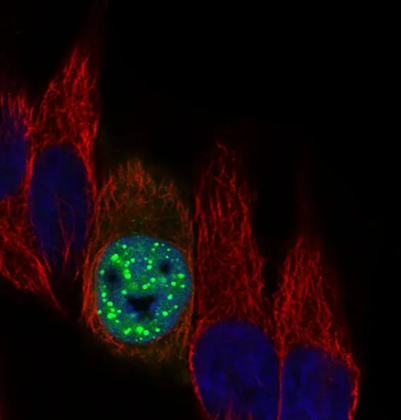 Fluorescent imaging of cells used in biomedical research