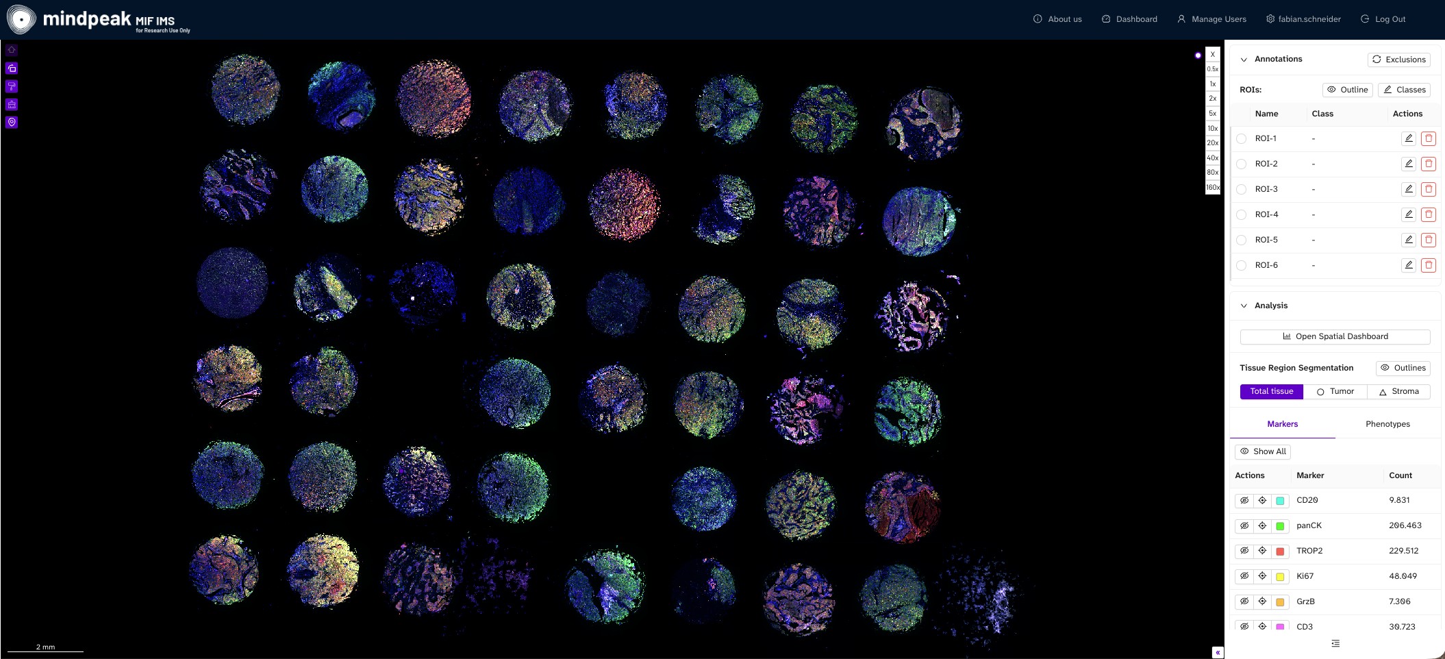 TMA overview in PhenoScout AI