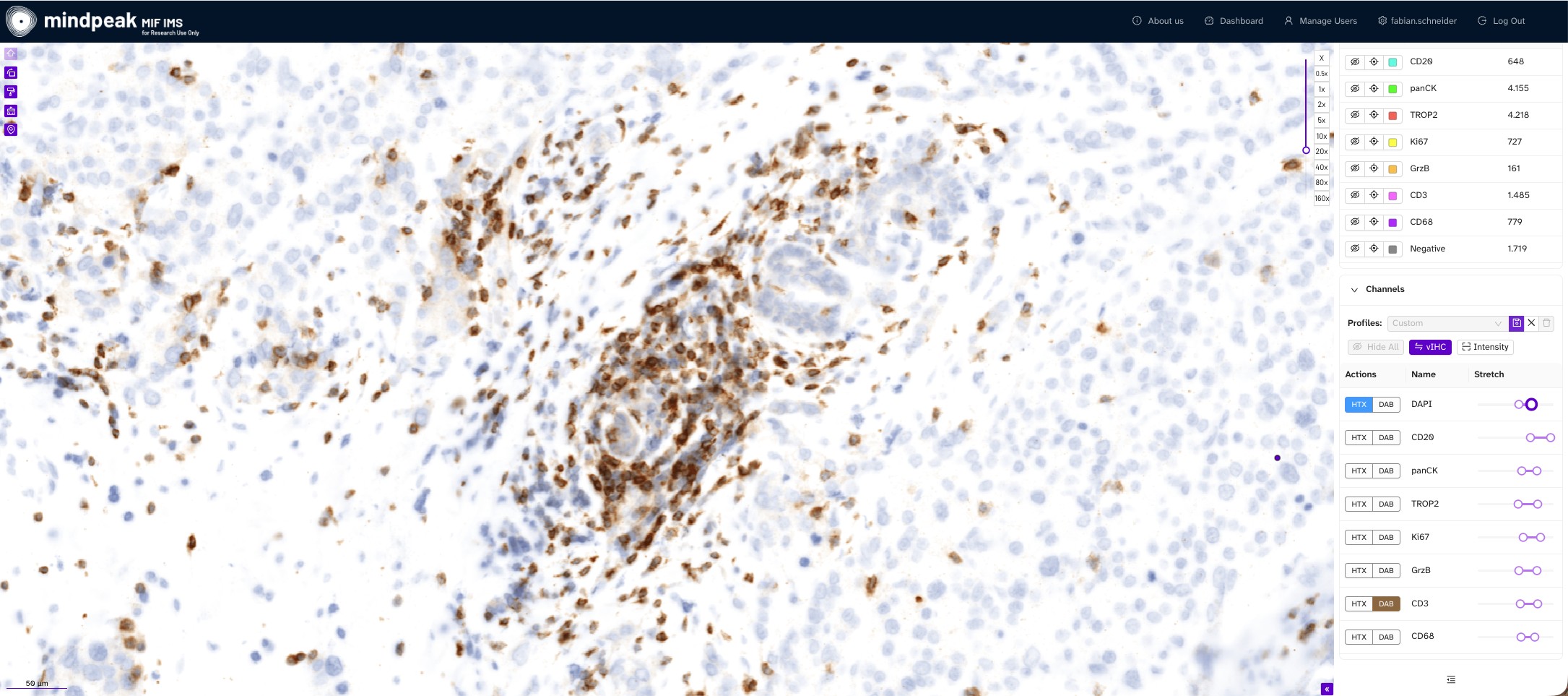 vIHC overview in PhenoScout AI