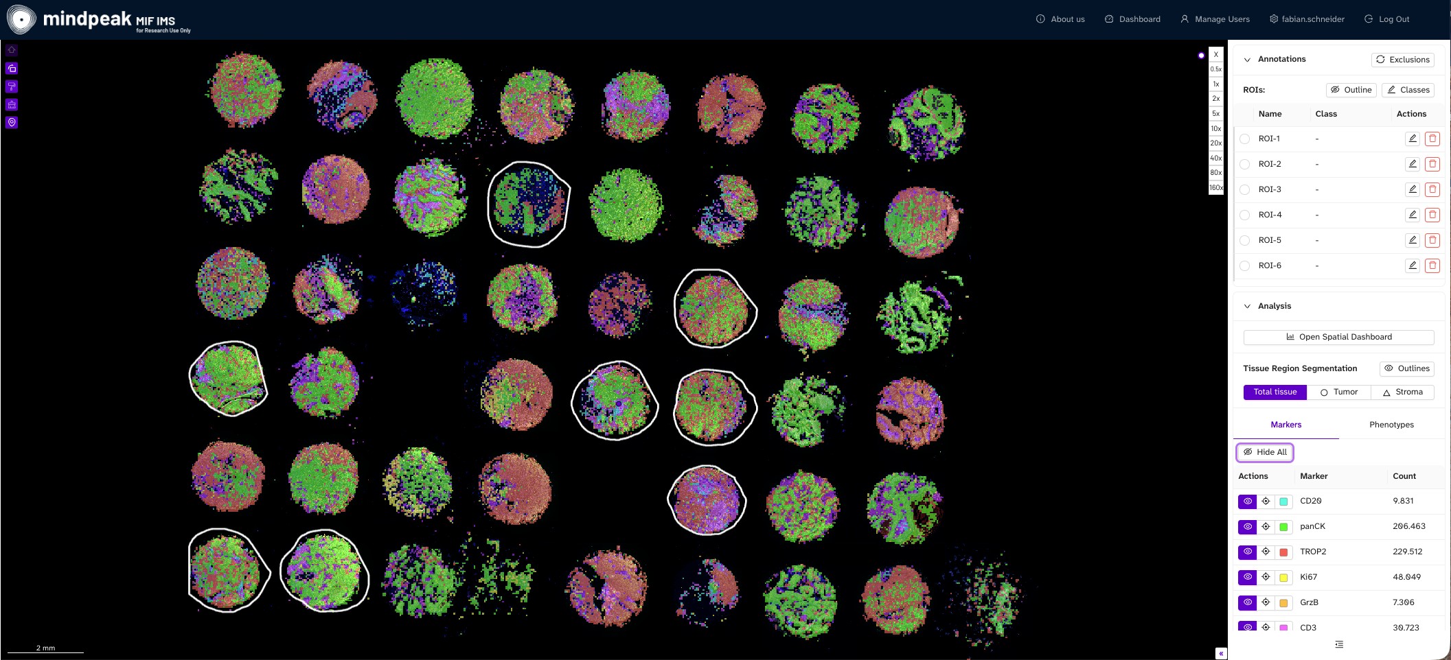 Markers in PhenoScout AI
