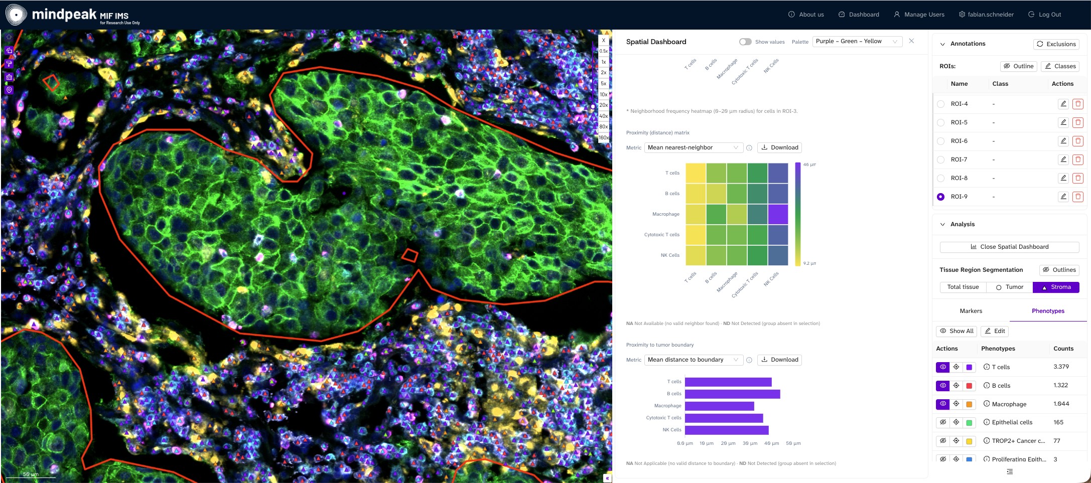 Tissue region segmentation with tumor outlines in PhenoScout AI