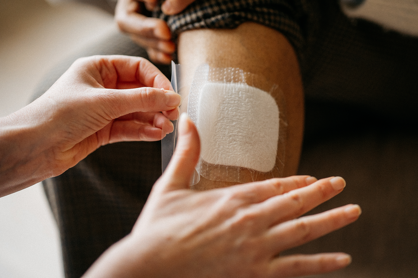 Applying silicone dressing on leg