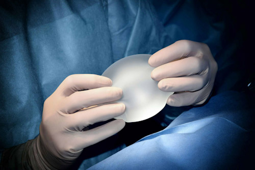 Breast implant held by a surgeon's hands in sterile operating room setting. Photo by philippe spitalier on unsplash.com