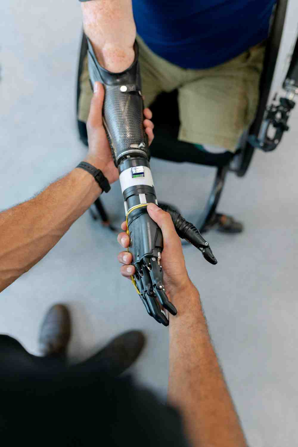 A man with a right upper extremity amputation shakes hands with a myoelectric prosthesis