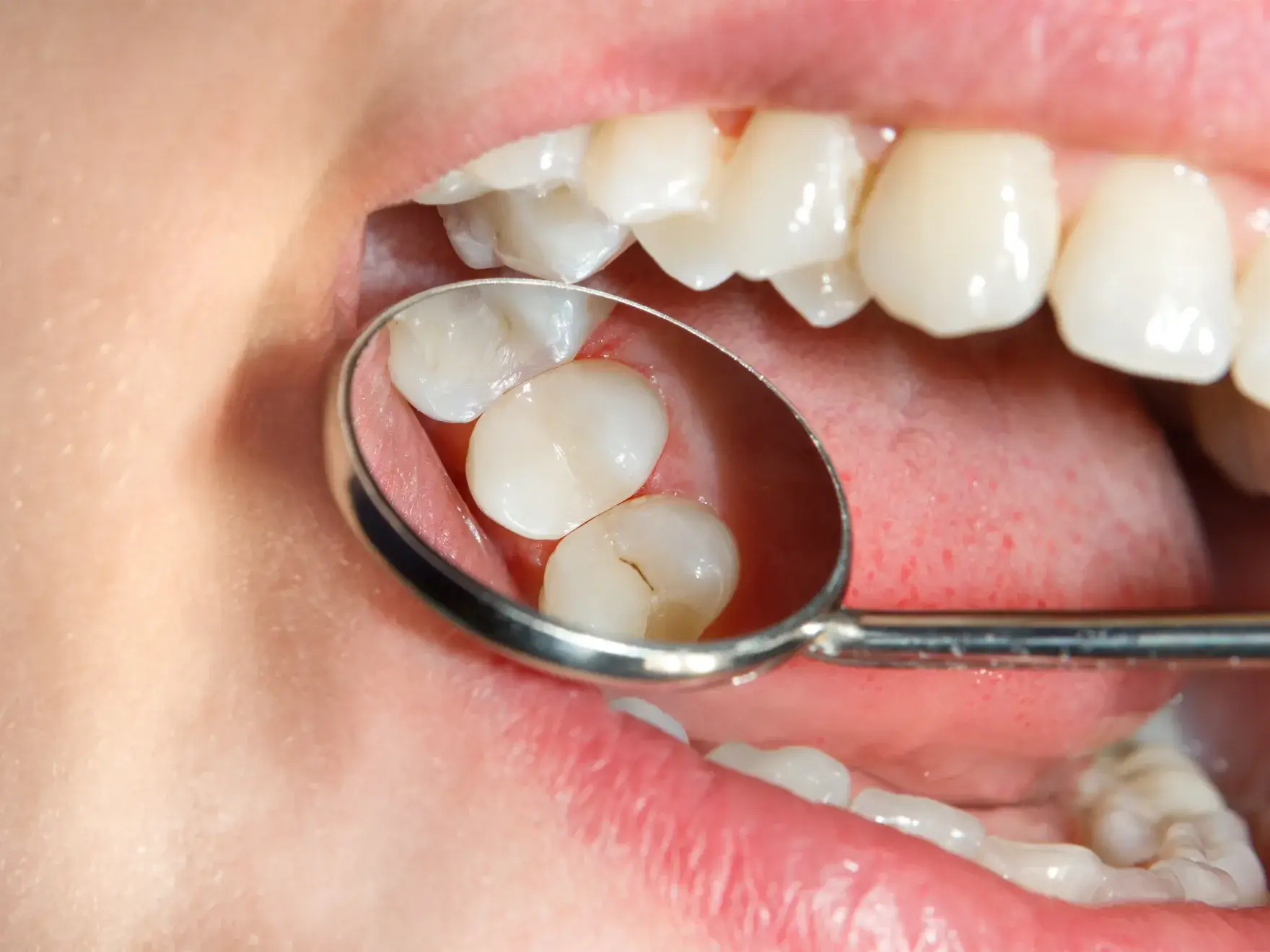 A close up of a person with a spoon in their mouth.