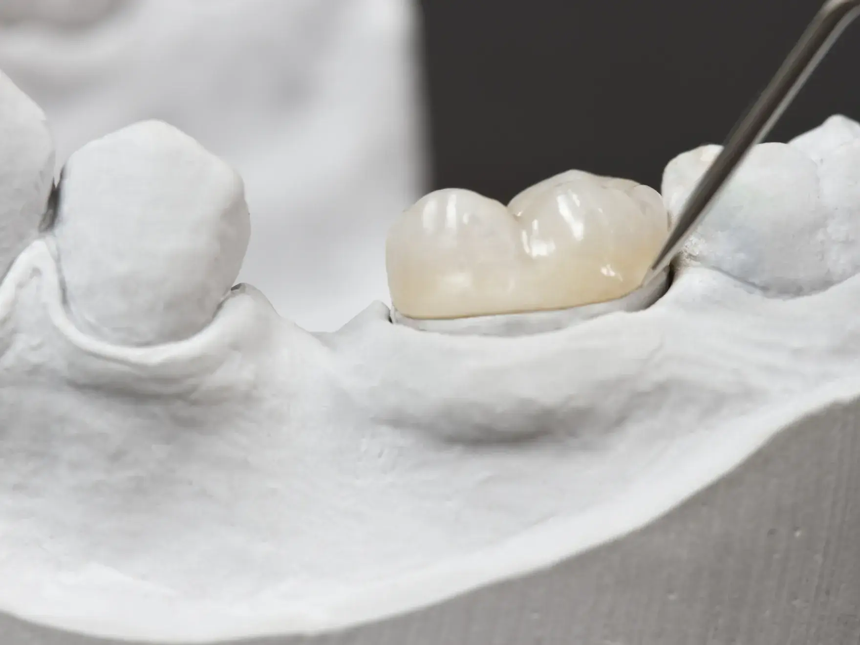A model of a tooth with a dental tool in it.