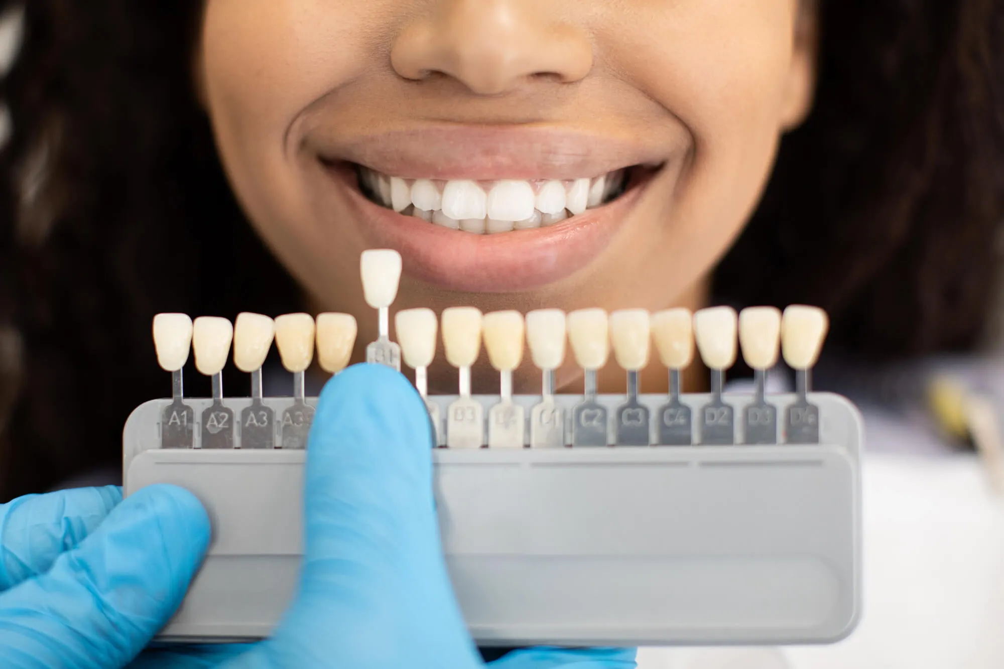 woman choosing shade for her teeth whitening