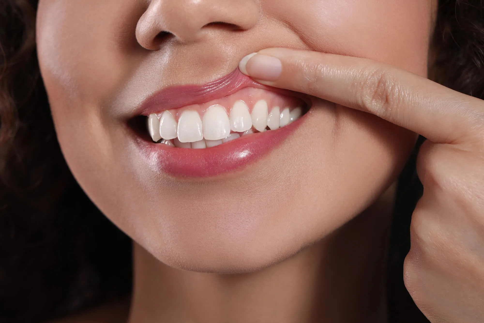 woman showing her gums