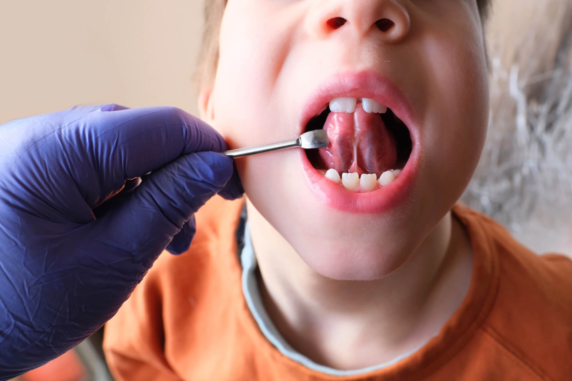 little boy getting an oral exam