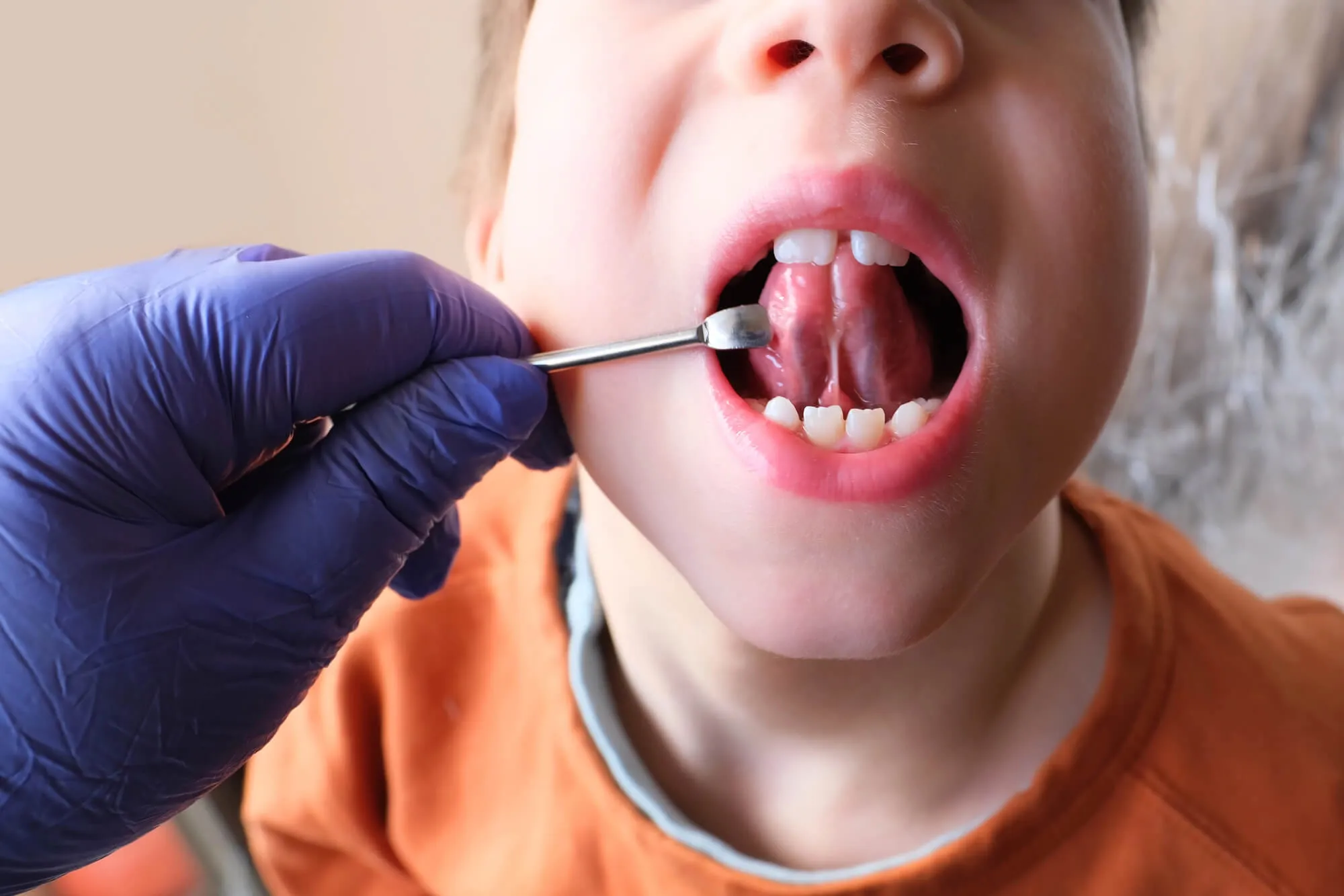 little boy getting an oral exam