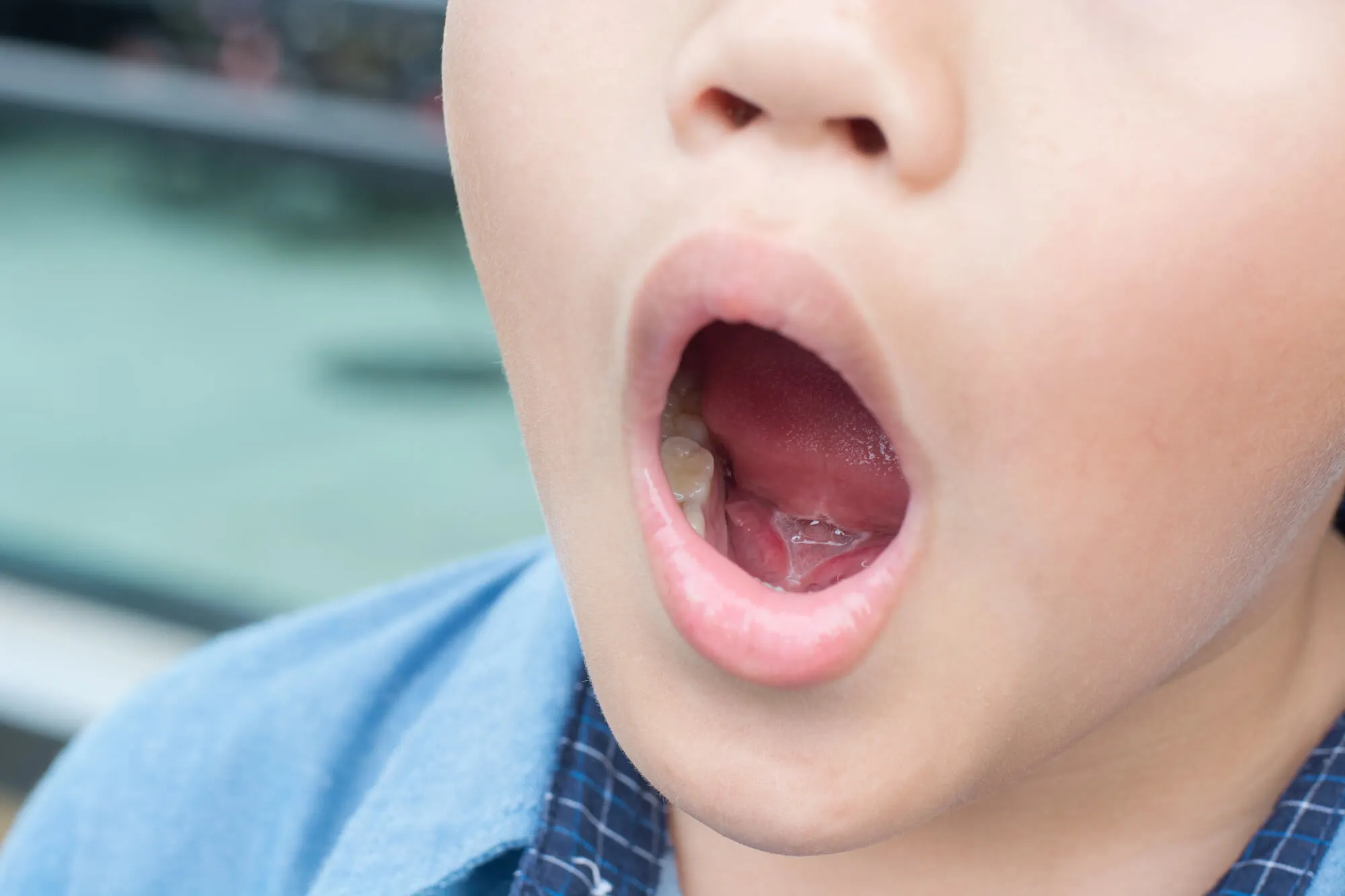 little boy getting an oral exam