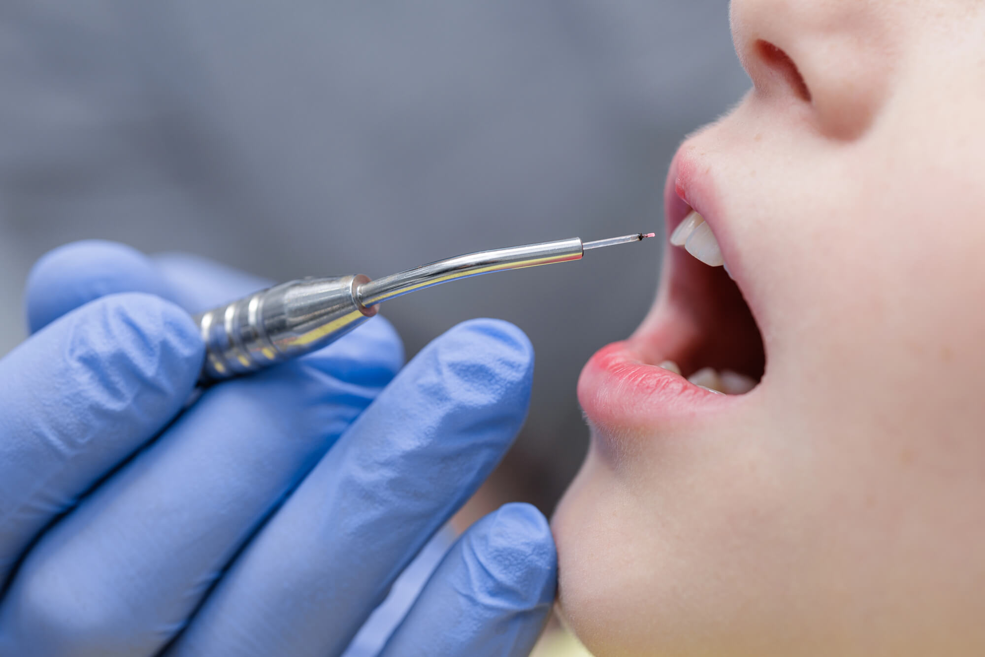 little boy getting an oral exam