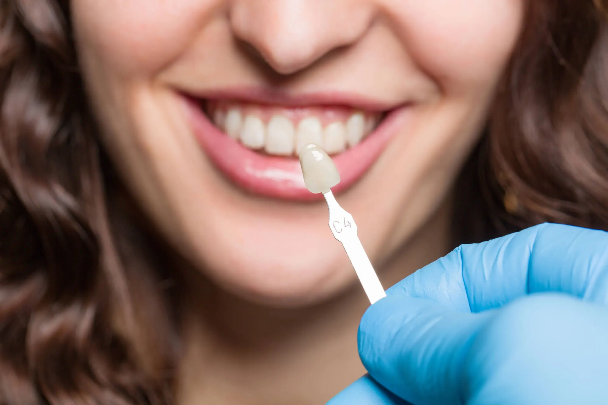 woman choosing shade for her teeth whitening
