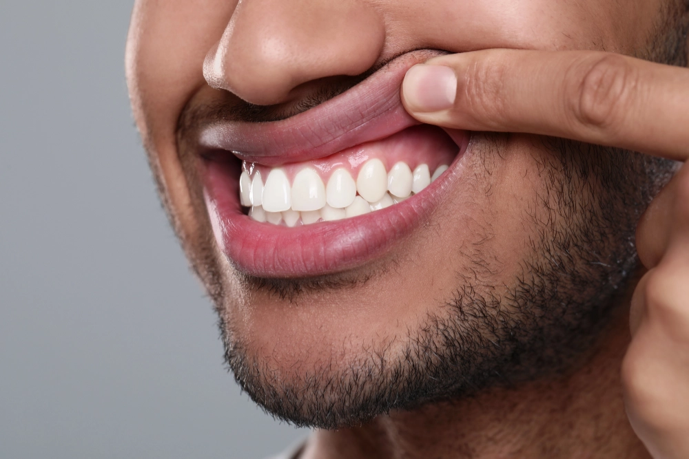 man showing his gums and teeth