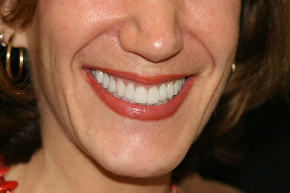 white smile