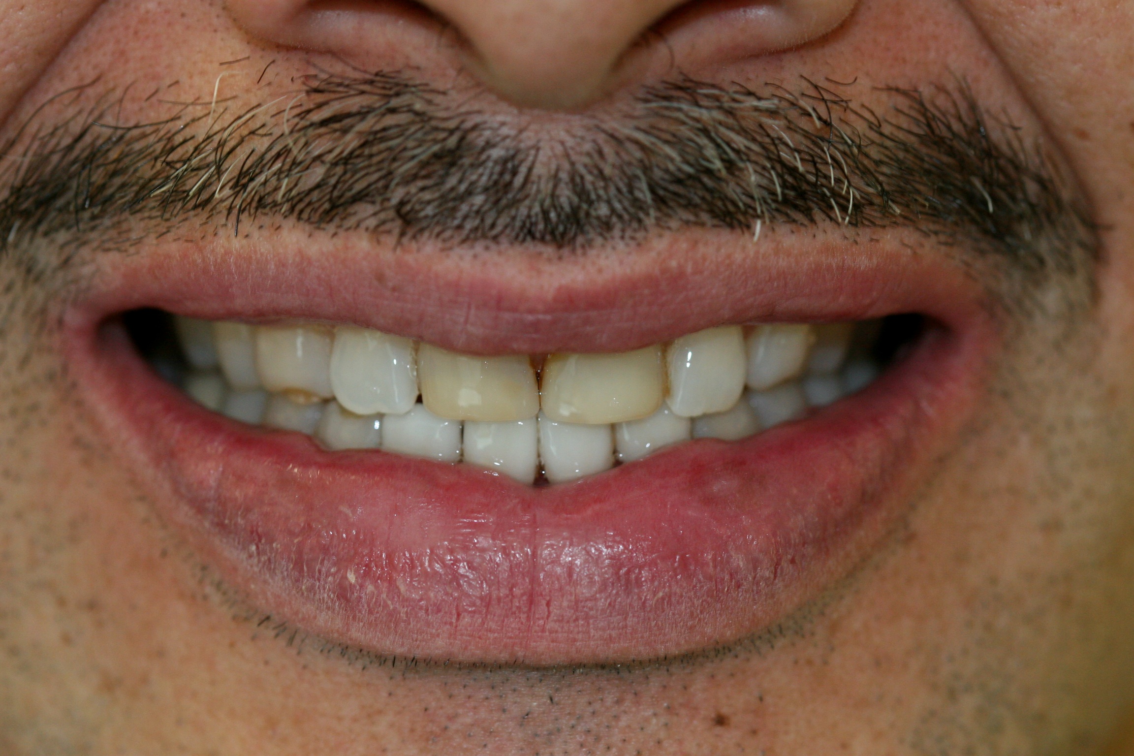 man with yellow front teeth