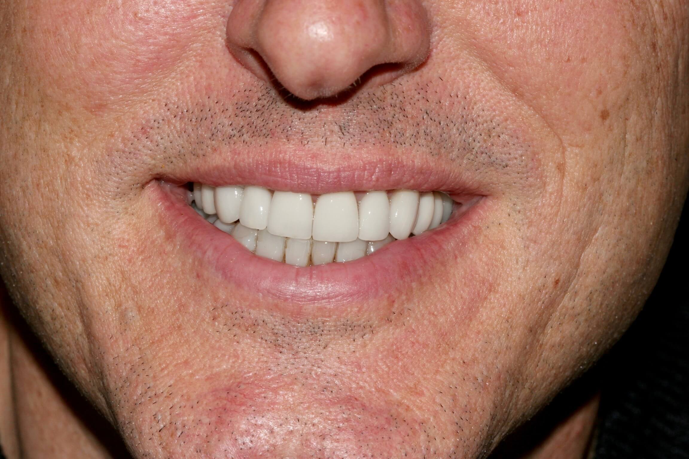 man with white smile