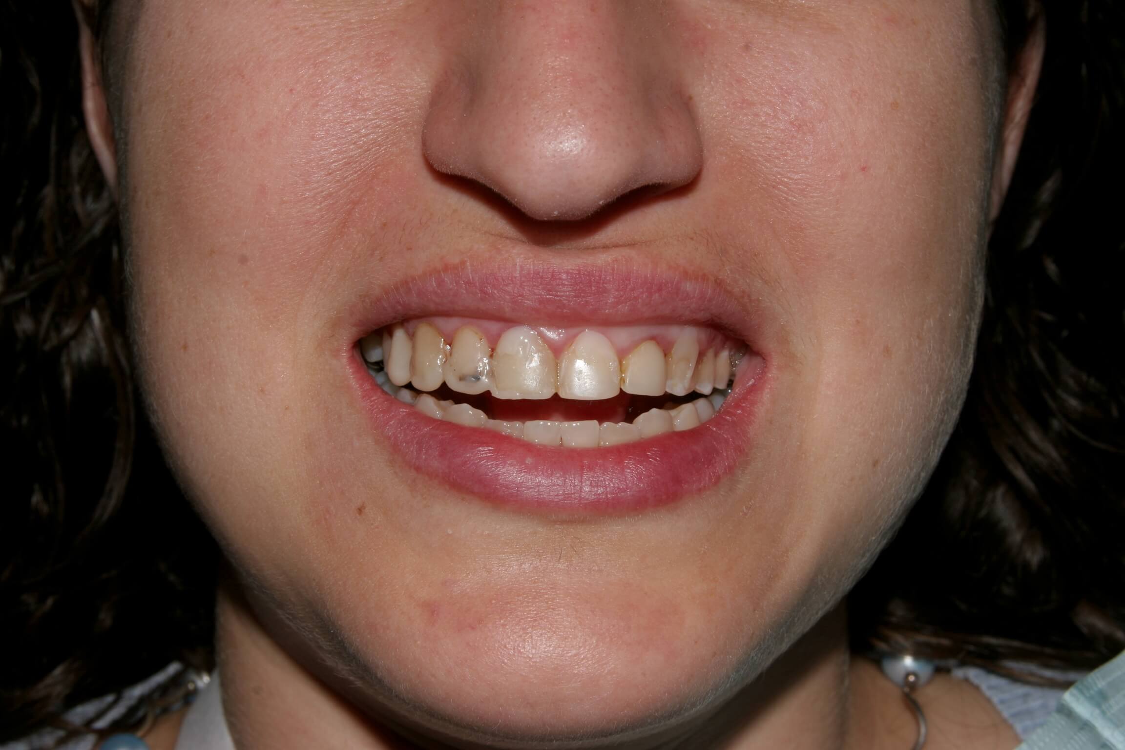 person with yellow teeth