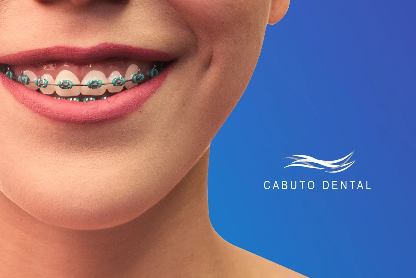 Cabuto Dental branded visual of a smile with braces