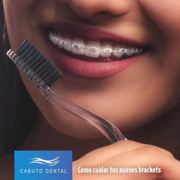 Cabuto Dental social post on how to care for new braces
