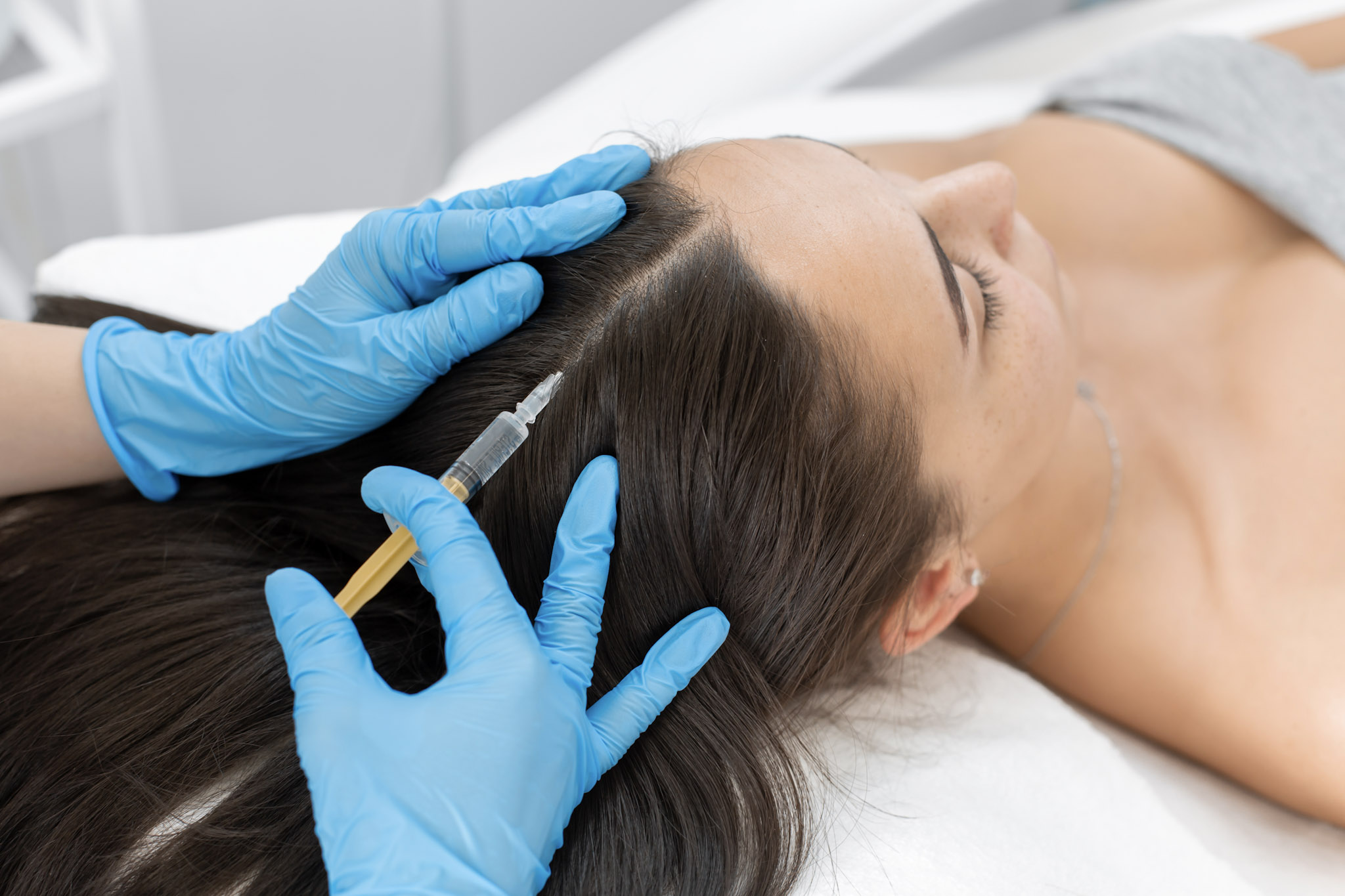 PRP Eigenbluttherapie in Traisen zur Unterstützung des Haarwachstums und Aktivierung der Haarwurzeln.