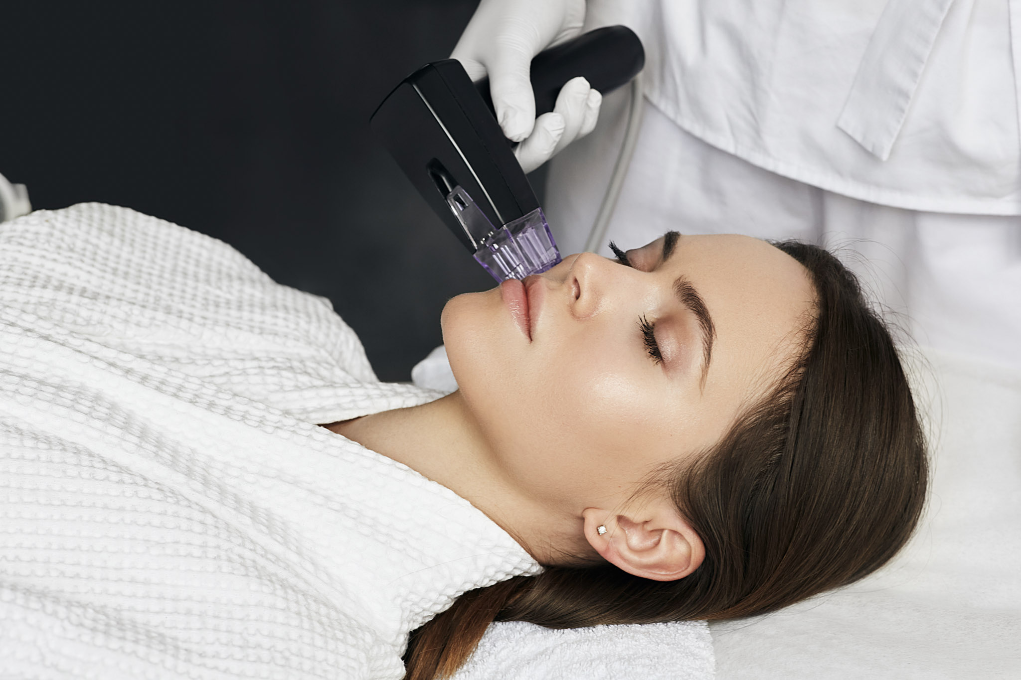Morpheus8 Behandlung mit Radiofrequenz-Microneedling zur Verbesserung von Hautstruktur und Hautfestigkeit