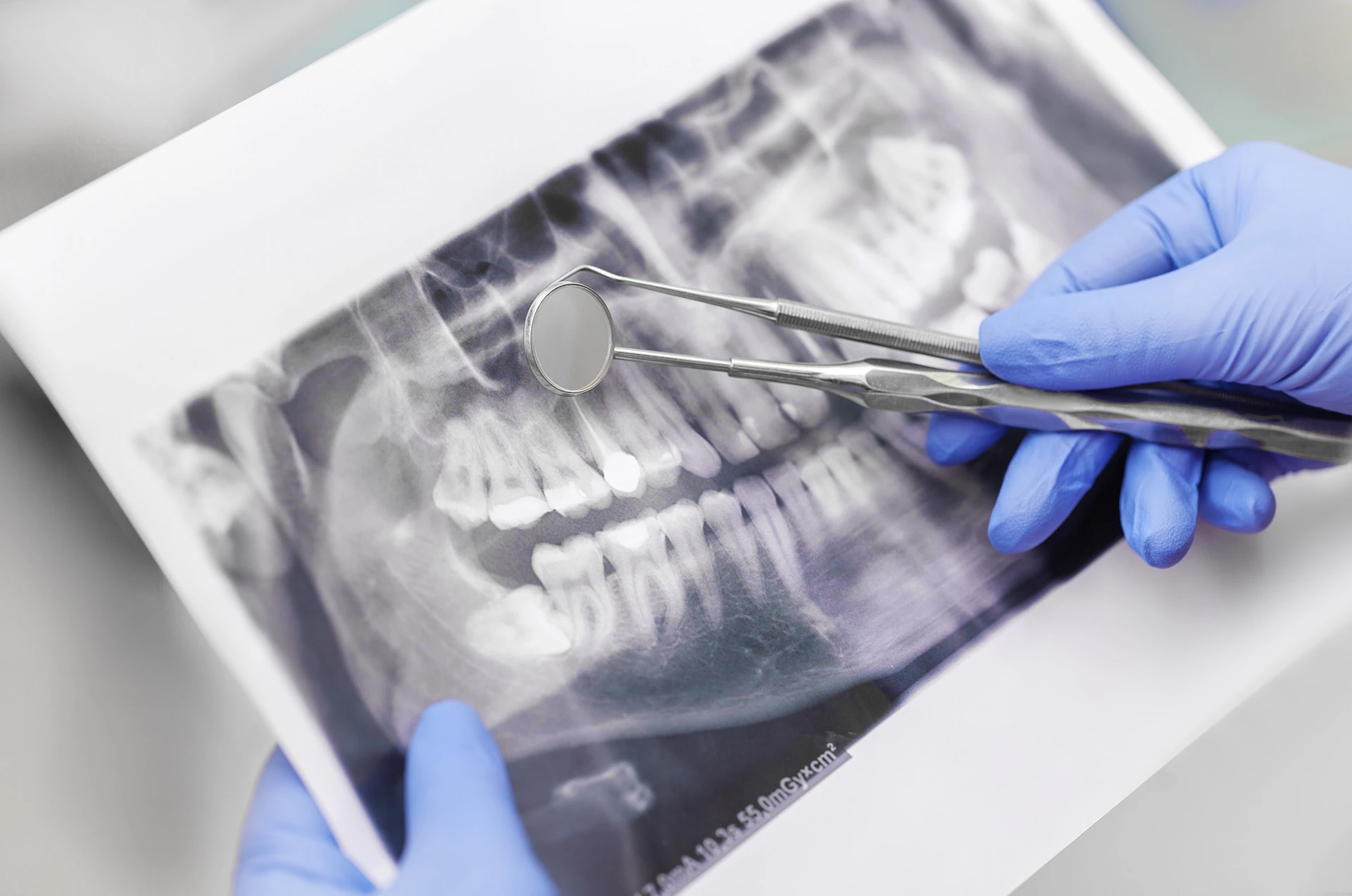 Endodontist in Concord