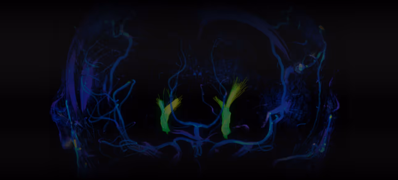A brain scan showing neuro vasculature in high contrast blue and green