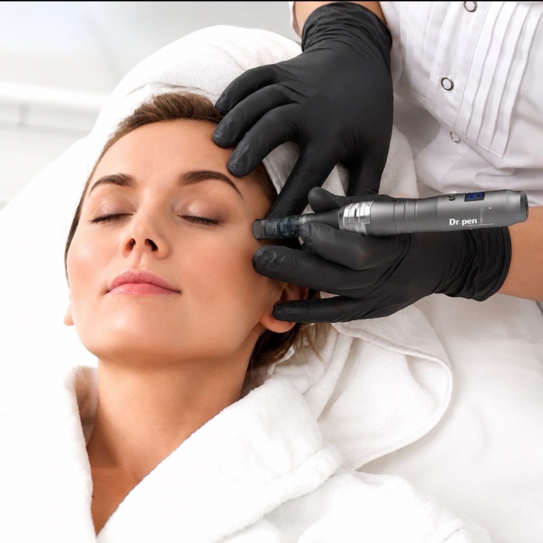 Microneedling