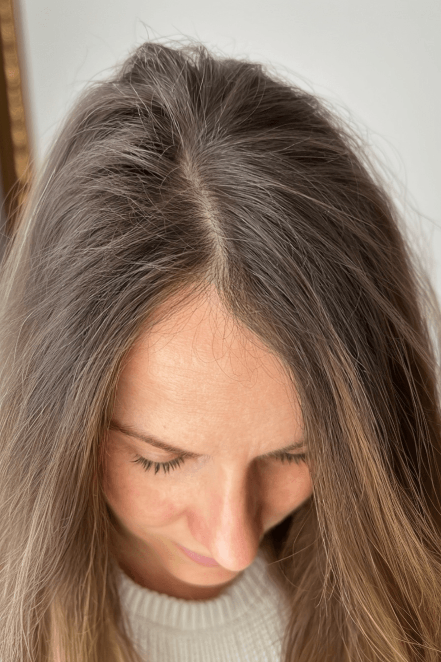 Haarbild von Oxana L. nach 5 Monaten PRP Behandlung mit Supplements