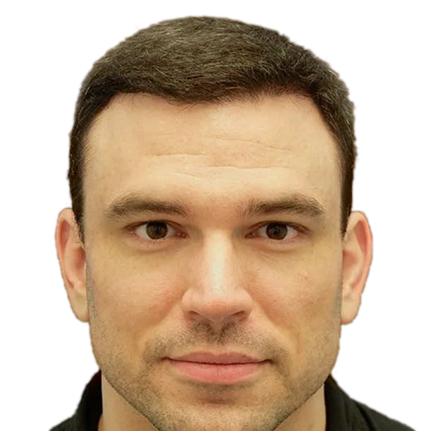 6 Monate: Haartransplantation FUT, 1.800 Grafts, Front