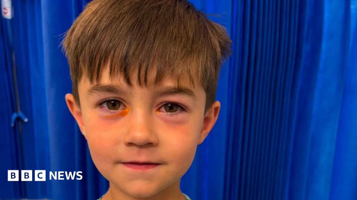 Shein fake squishy toy explodes in Bridgend boy's face