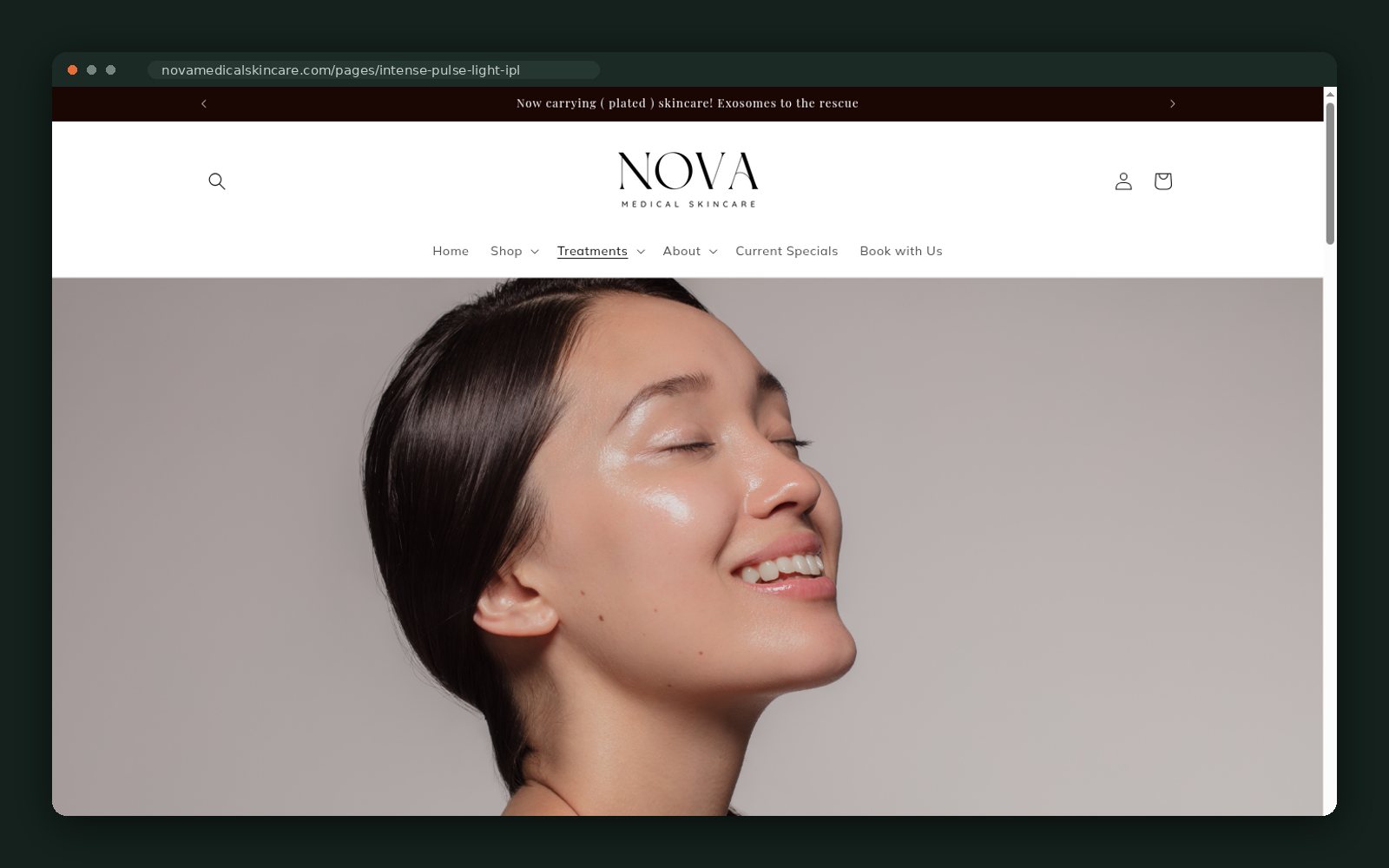 IPL treatment page