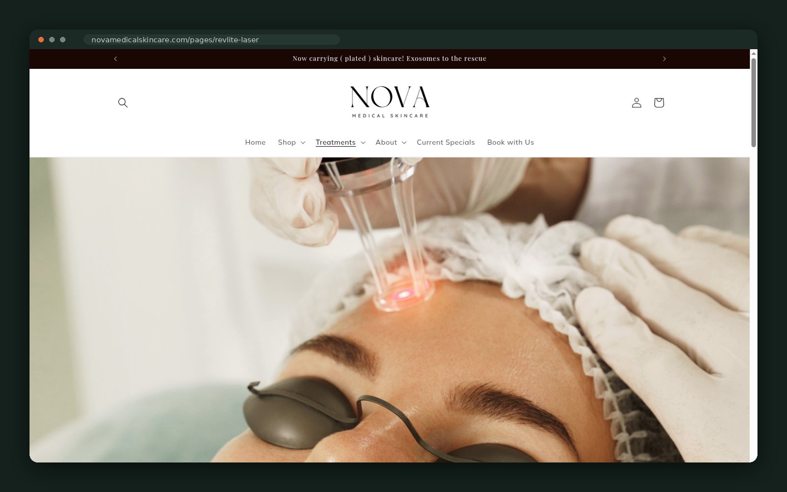 RevLite laser treatment page