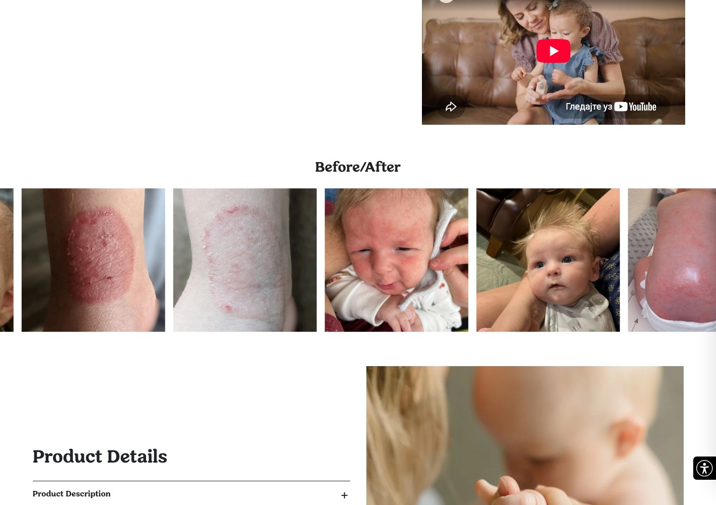 Customer video testimonial above the before and after photo strip
