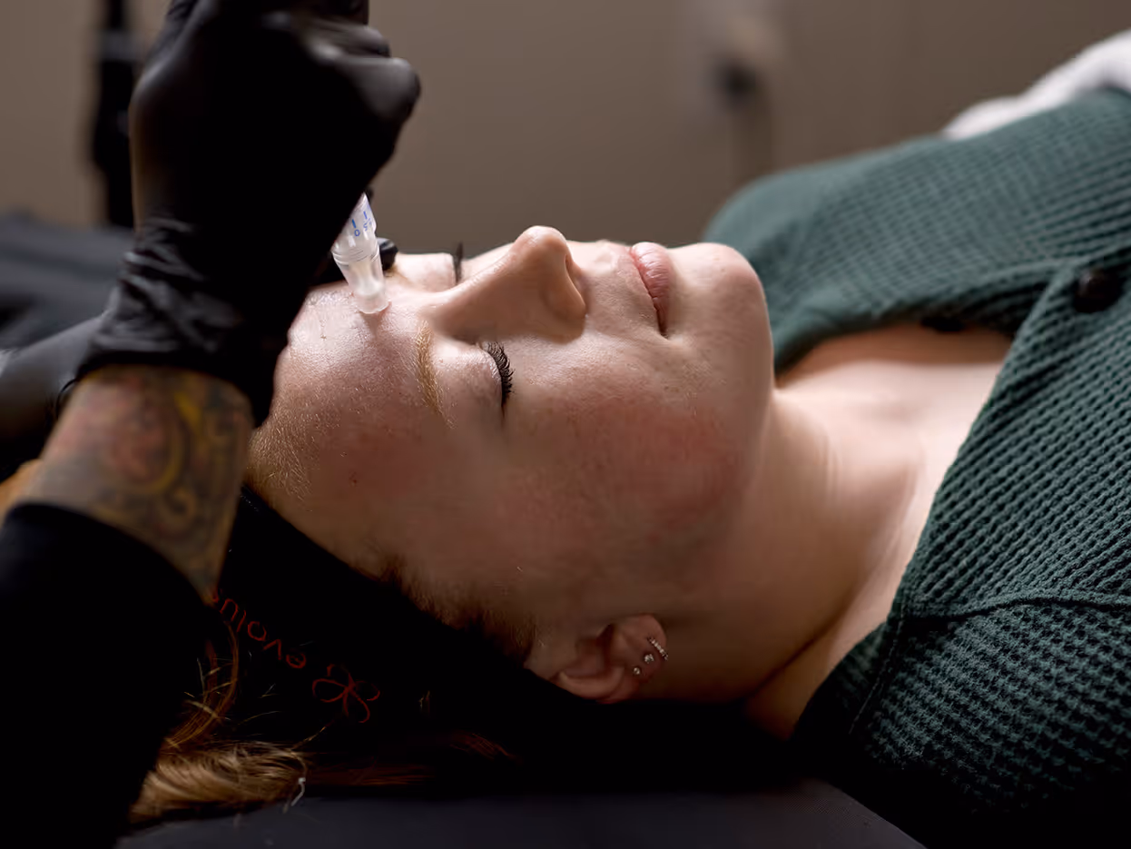 Close-up of a woman receiving a microneedling facial treatment with a handheld device.