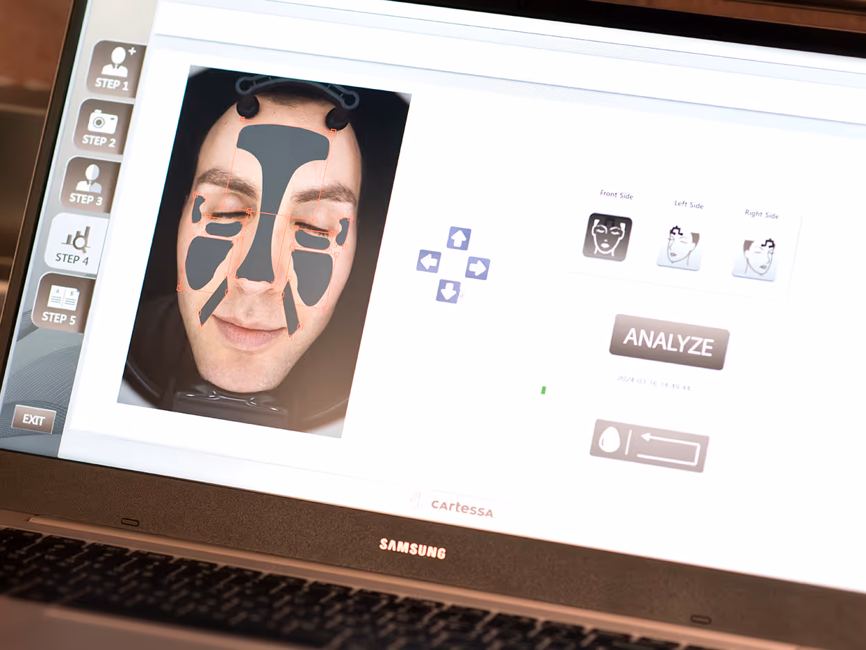 Laptop screen displaying facial scan analysis software highlighting facial regions with overlay shapes around eyes, nose, and cheeks.