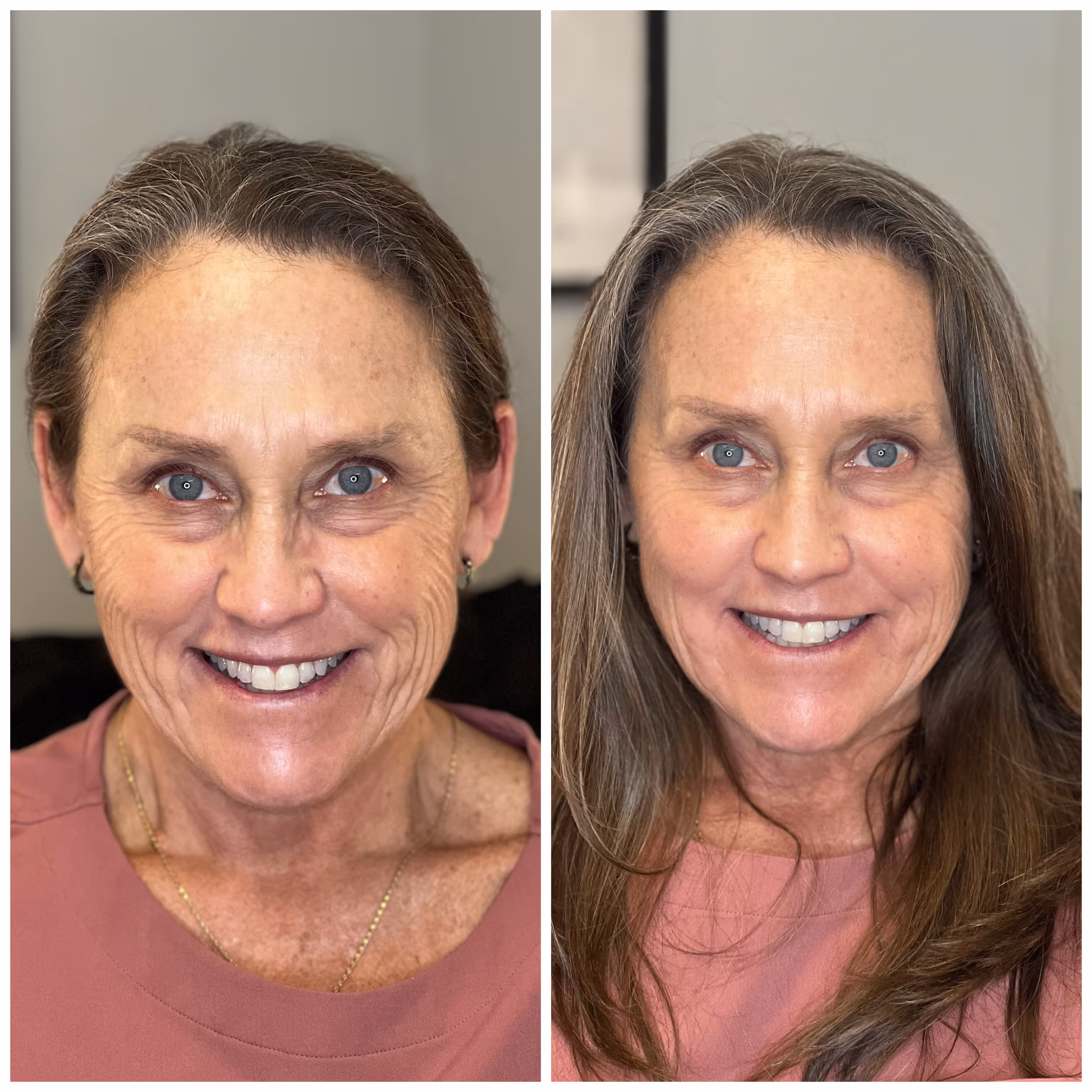 Side-by-side before and after photos of a smiling middle-aged woman showing reduced facial wrinkles and fuller hair in the after photo.