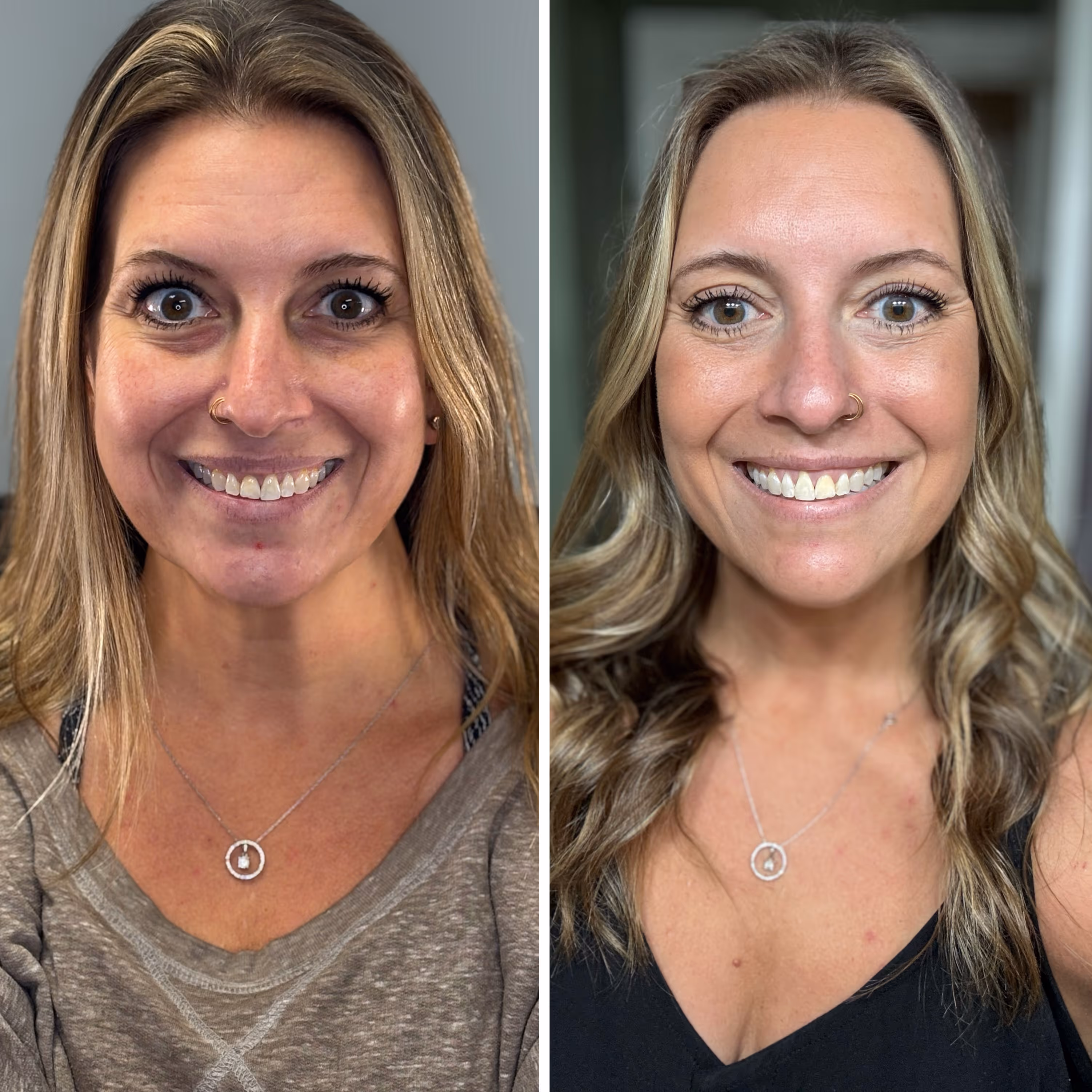 Side-by-side before and after photos of a smiling woman showing improved skin tone and hair styling.