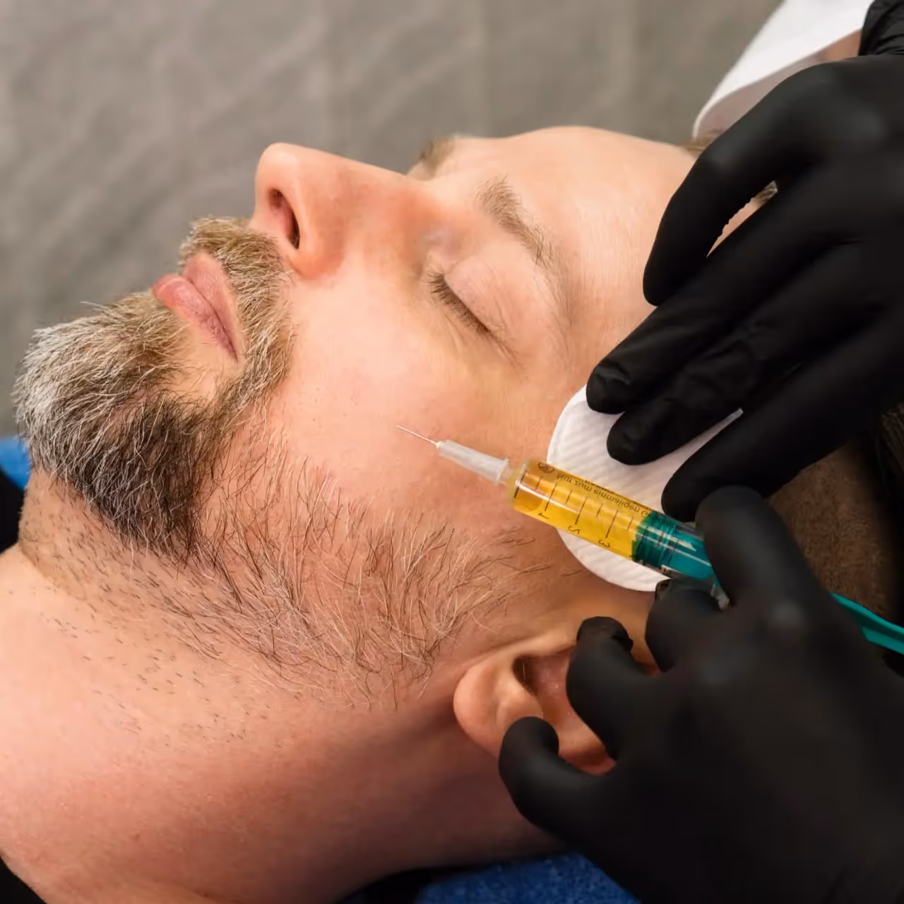 Close-up of a man with closed eyes receiving a yellow liquid injection in the cheek by a professional wearing black gloves.