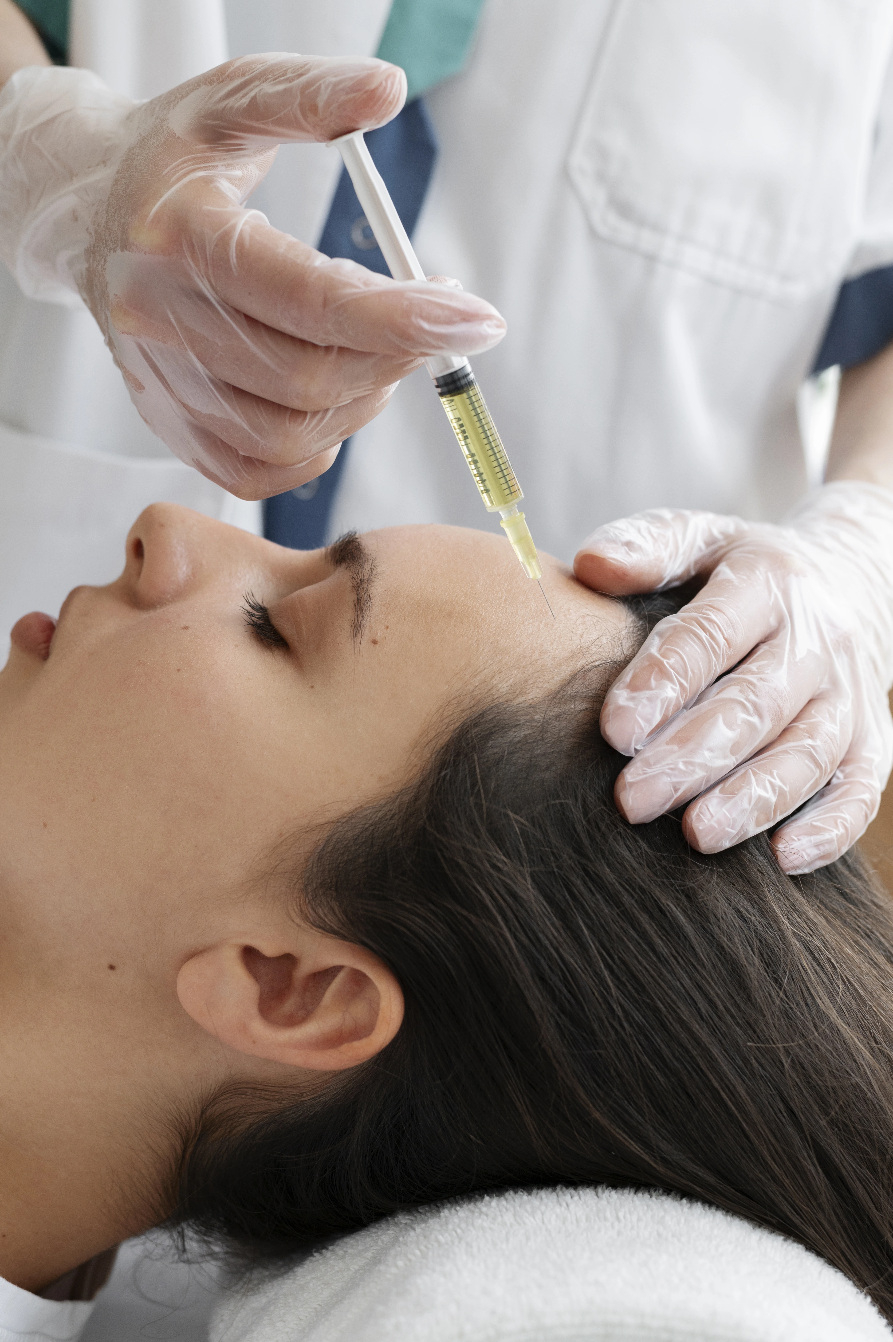 Close-up of a woman receiving a PRP injection on her forehead from a gloved healthcare professional.