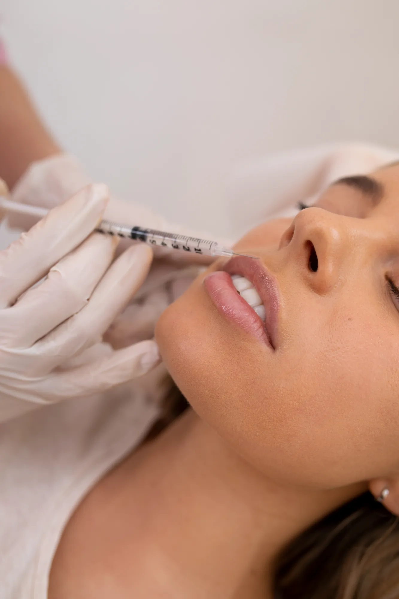 Close-up of a woman receiving a lip filler injection in her upper lip by a gloved hand.