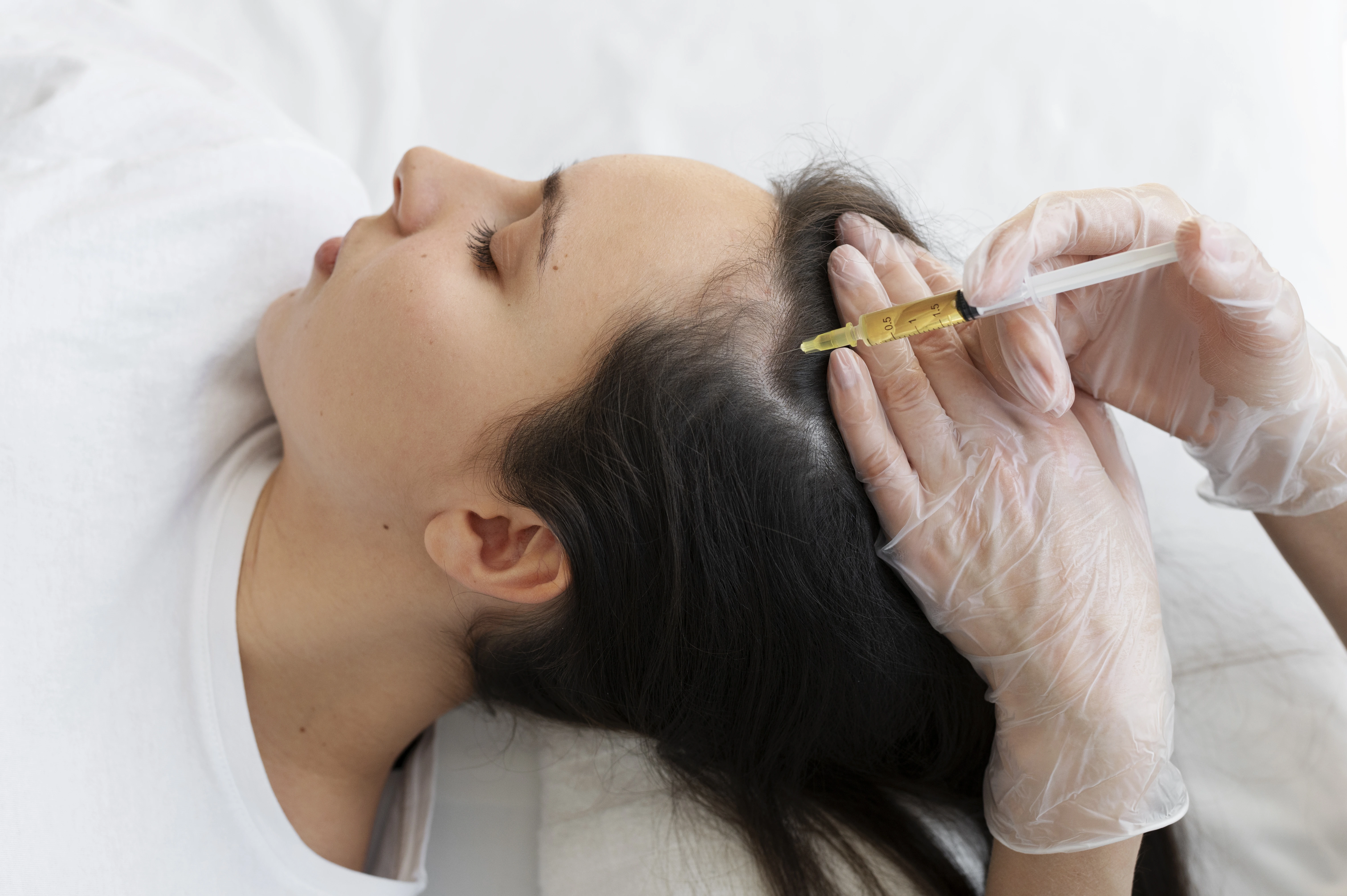 Person lying down receiving a scalp injection from a gloved practitioner holding a syringe.