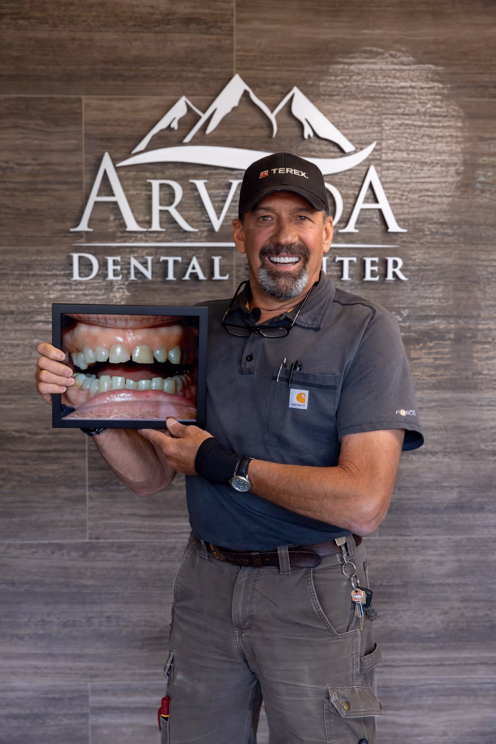 Full mouth dental implant patient result at Arvada Dental Center & Implants in Arvada, CO