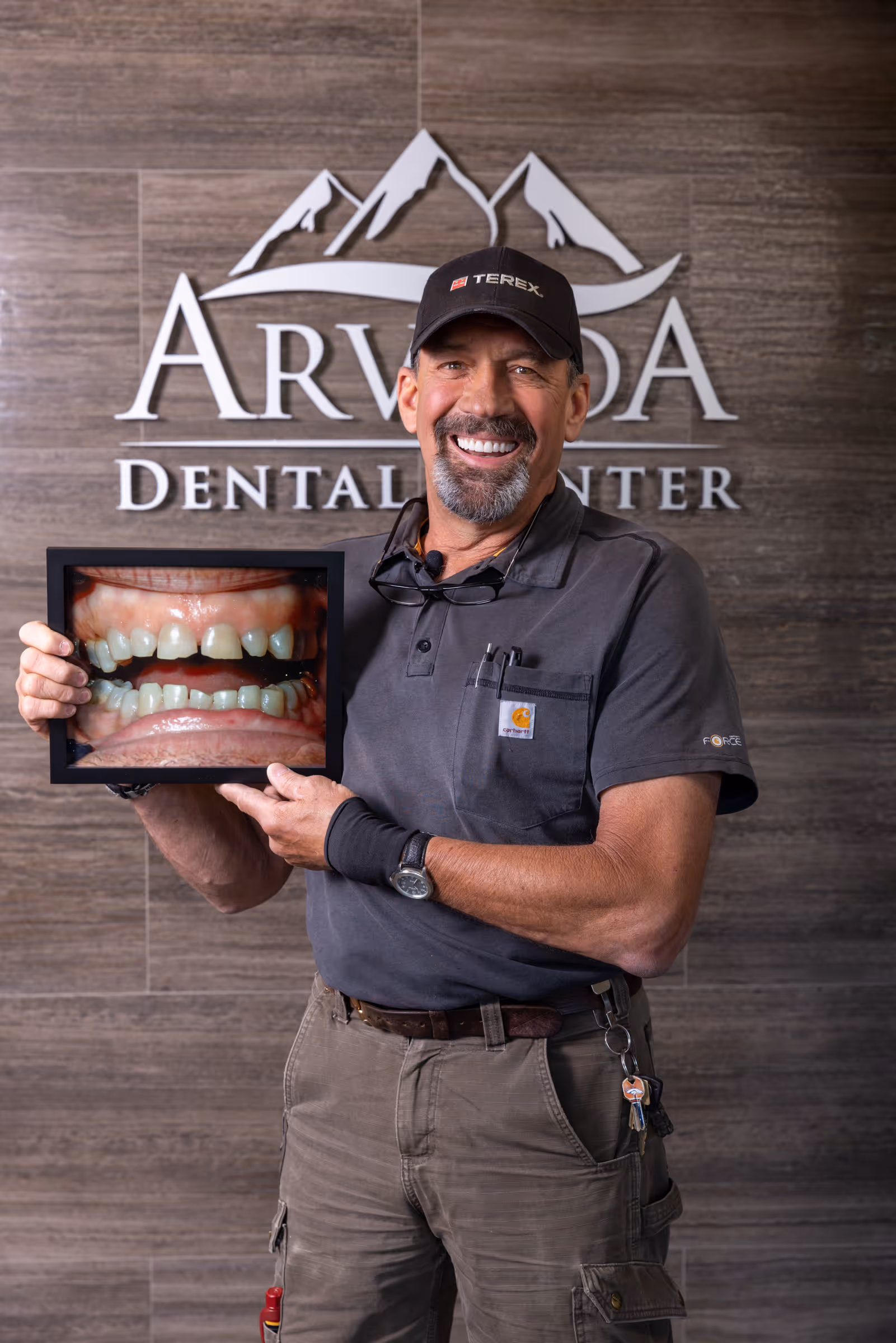 All-On-X dental implant patient Chris before and after treatment at Arvada Dental Center & Implants