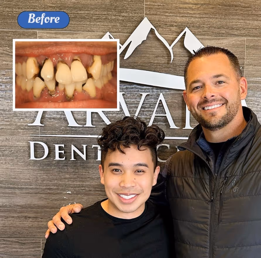 Full arch dental implant patient transformation at Arvada Dental Center & Implants in Arvada, CO